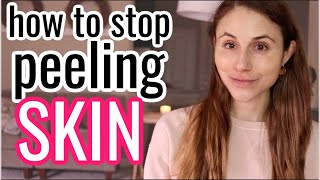 How to STOP PEELING SKIN| Dr Dray