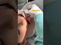 #viral #alineadora #bracket #ortodoncia #tiktok #invisalign #dentista #fyp #odontologia #shorts