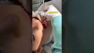 #viral #alineadora #bracket #ortodoncia #tiktok #invisalign #dentista #fyp #odontologia #shorts