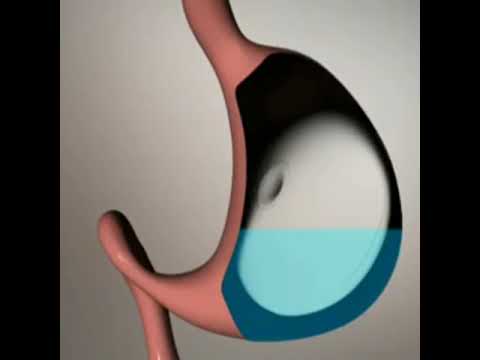 Clinica perder peso zaragoza