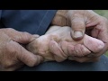 The Cultural Significance and Impact of Foot Binding in China