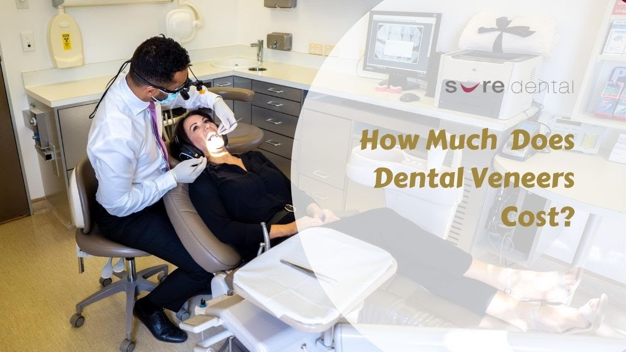 How Much Does Dental Veneers Cost? YouTube