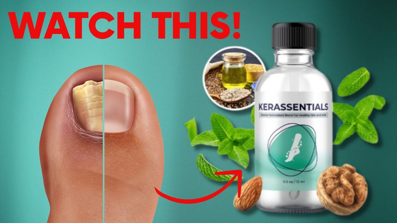 Kerassentials ((Watch this)) kerassentials Review