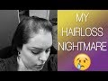 MY HAIRLOSS NIGHTMARE