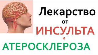 картинка: Все врачи знают!!! Оксид азота- лекарство от ИНСУЛЬТА и АТЕРОСКЛЕРОЗА