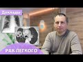 Рак легкого: UPDATE 2016 – взгляд радиолога. Андрей Мангов