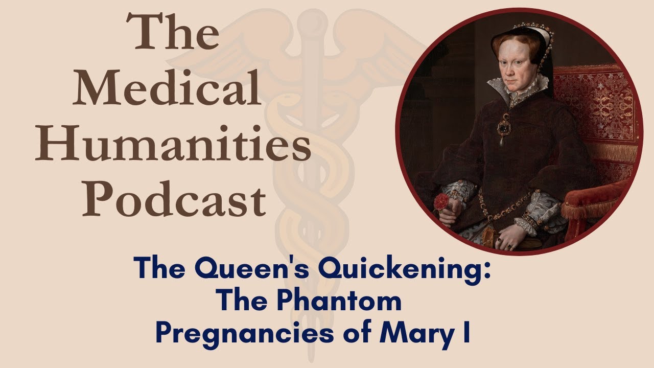 2: The Queen's Quickening: The Phantom Pregnancies of Mary I  (medicine in history)