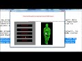 Medical Image Processing Projects Using Matlab | Medical Image Processing Thesis Using Matlab