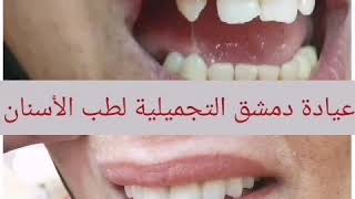 عيادة دمشق التجميلية لطب الأسنان في ولاية عبري