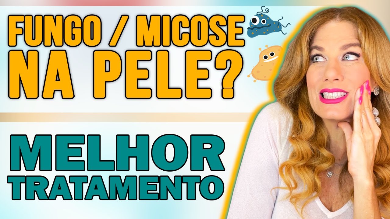 Fungo Na Pele Micose De Pele: Principais Causas, Sintomas E Tratamento