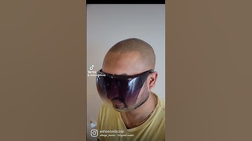 3rd session scalp micropigmentation #scalpmicropigmentation #hairloss #hairtransplant