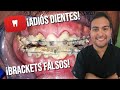 BRACKETS FALSOS 😱 ¡EL PELIGRO DE LA ORTODONCIA CALLEJERA! (CASOS REALES) #41