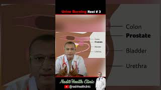 Burning Urination: UTI Hai Ya Pani Ki Kami? Doctor Ki Simple Guide - 3 #burningurination #uti