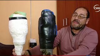 Hombre que perdió su pierna fabrica prótesis artesanales - CHV Noticias