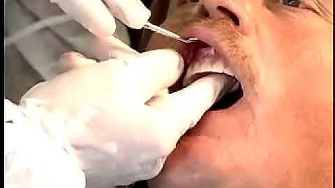 20 www.4dent.net - Denture Delivery