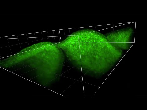 New 'BRAIN' Tool