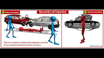 Accident Severity Prediction - Machine Learning Model