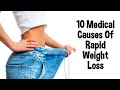 10 medical causes of rapid weight loss