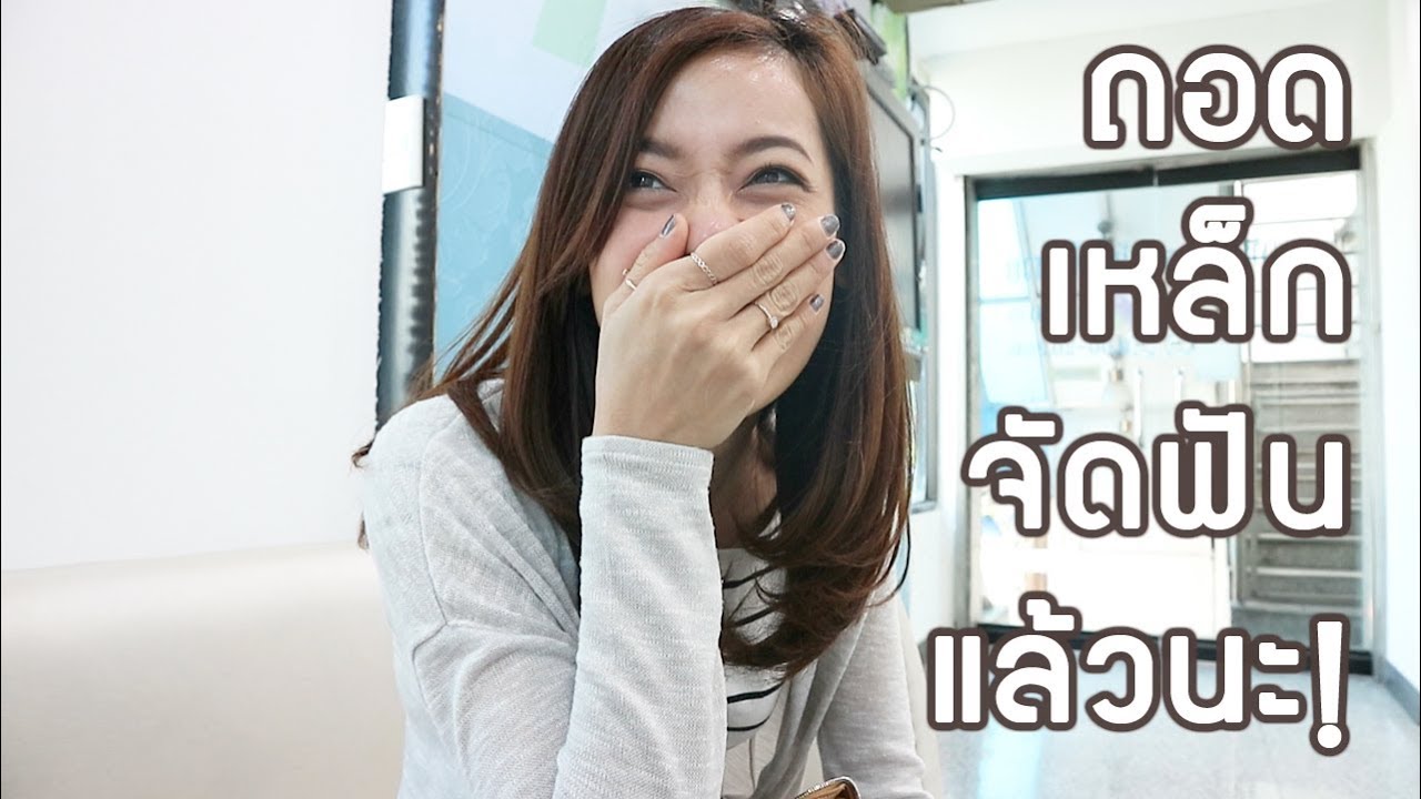 ถอดเหล็กจัดฟันแล้วเด้อออ!