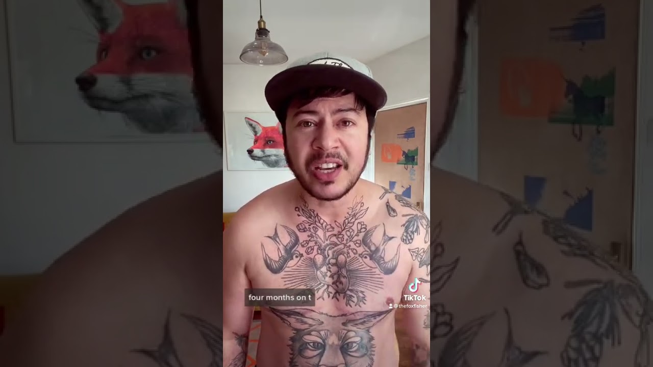 “Love documenting my transition” Fox Fisher 🏳️‍⚧️🌟🤣 