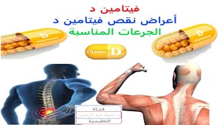 فيتامين D | تعرف على خطورة نقص فيتامين د والجرعات المناسبة | Vitamin D