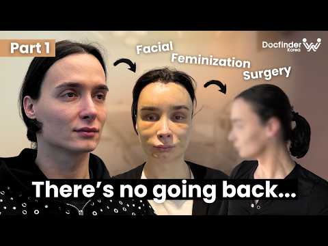 Swiss Woman's FFS Surgery in Korea | Forehead, Jaw & Brow Transformation