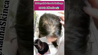 30 Days Hair Growth Challenge|Best Hair Oil for Triple Hair Growth#shorts #youtubeshorts #haircare