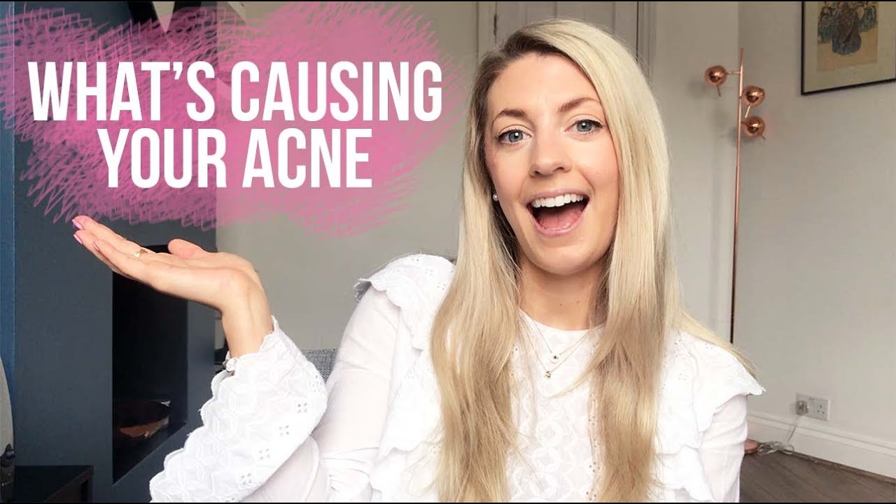 7 REASONS WHY YOU'RE BREAKING OUT YouTube