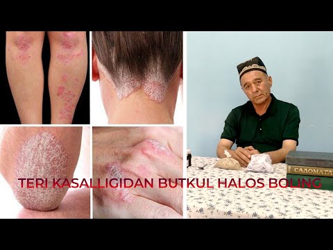 Video: De Bästa Psoriasisbloggarna 2020