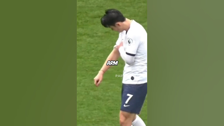 This player scored 2 goals with a broken arm