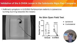 Evaluating The A13 Nucleus As A Novel Deep Brain Stimulation Target Parkinsons Disease -Ryan Karch