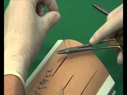 CSL: Cruciate suture pattern