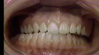 The Clinical Occlusal Examination