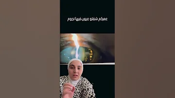 لو عيونك فيها نجوم بتحب تعرف ولا تضل مش عارف اكتبولنا بتتوقعوا هاي الحالة بتأثر على النظر ولا لأ 