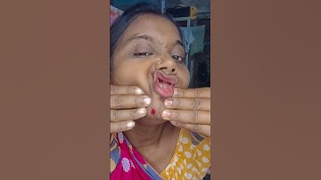 How I Cured a Bug Bite with Yogurt in the Wild#comedy