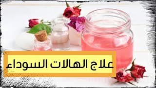 علاج الهالات السوداء/التخلص من الكلف والبقع السوداء/انتفاخات اسفل العين(معجزات ماء الورد)