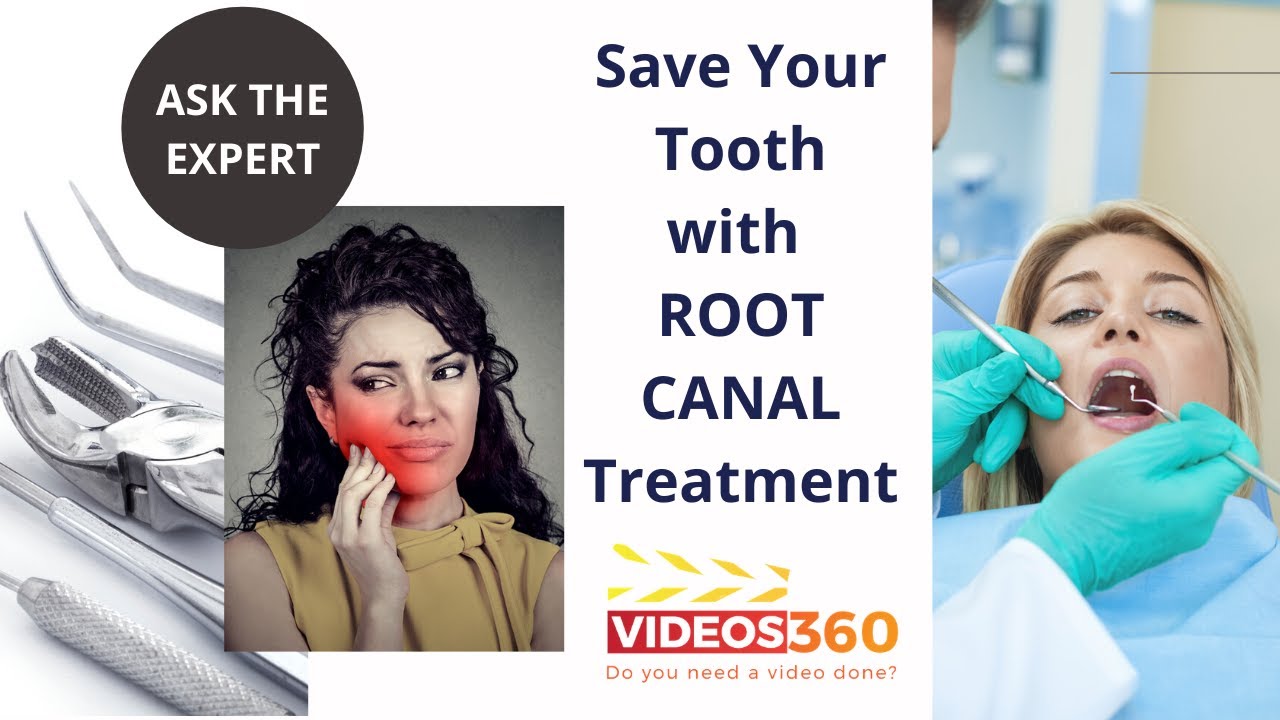 Root canal treatment at Brampton dental explained by Dr. Azeem Sheikh