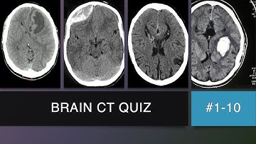 Brain CT Scan Quiz #1 - 10