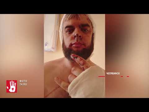 Преступники, избившие адвоката у подъезда, будут отвечать перед законом!