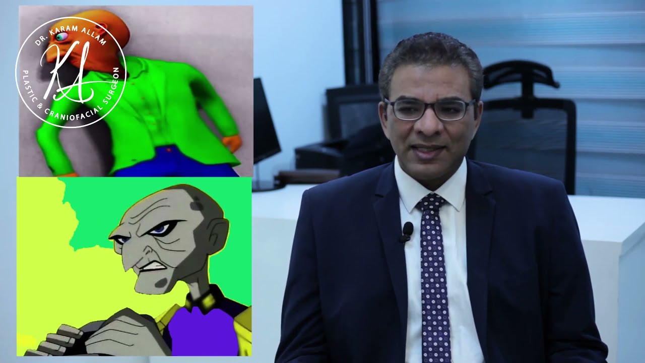 الشفه الارنبيه أهم الاستفسارات