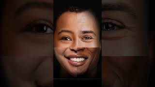 Why Copper Is Crucial for Vitiligo Healing #VitiligoDiet #CopperForVitiligo