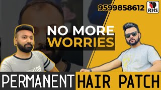 A non surgical small size hair patch system by anas sheikh in delhi call  us 9650914665 whatsap also  YouTube