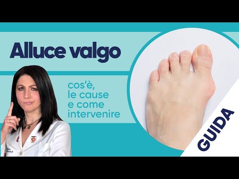 Video: Perché si verifica l'alluce valgo?