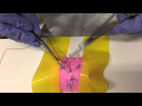 Hemostasis by suturing