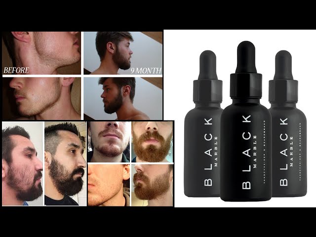 Black Marble Beard Oil - زيت بلاك ماربيل التركي لتطويل و تكثيف اللحية و الشارب - YouTube