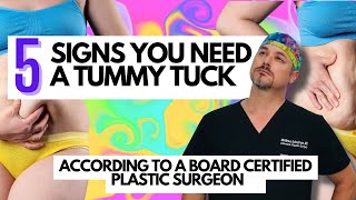 Do I need a Tummy Tuck? by Matthew Schulman MD 5,024 views 1 year ago 4 minutes, 22 seconds