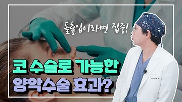 코성형하면 돌출입이 들어가 보인다?! 고양이수술(비순각수술)과 귀족수술