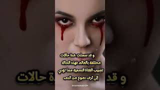 دموع دم  بكاء دم