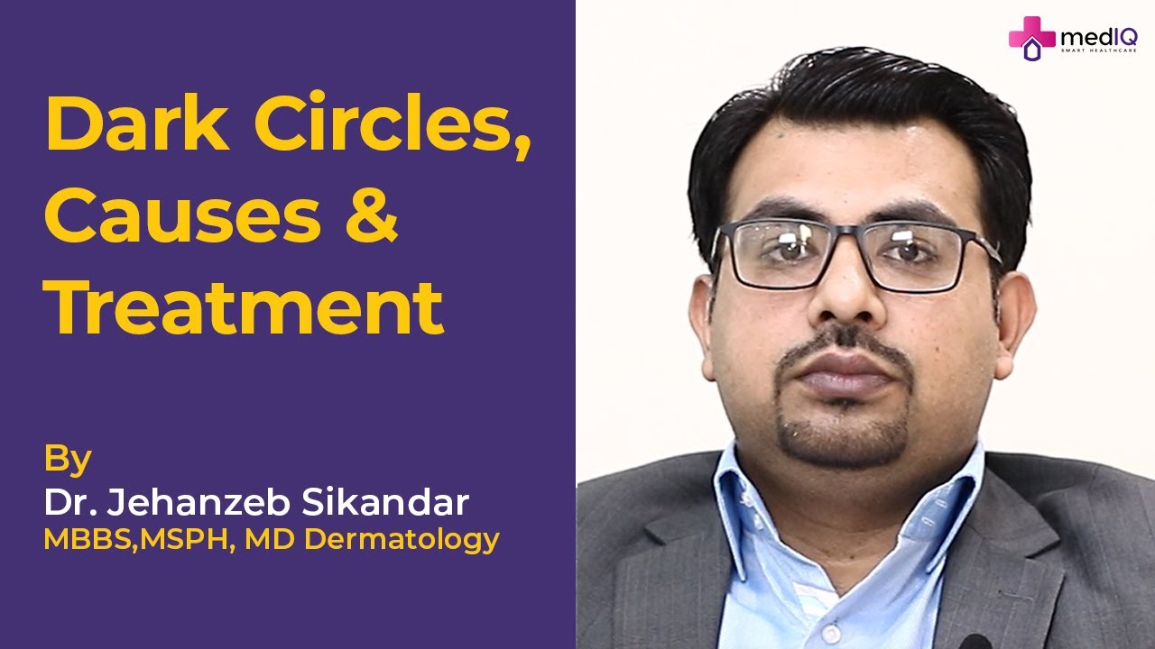 How to Remove Dark Circles | Causes of Dark Circles| Dark Circles Treatment| Urdu/Hindi