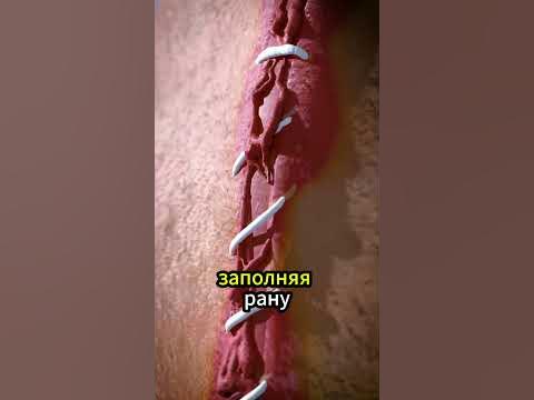 Как заживает сильный порез? #раны - YouTube
